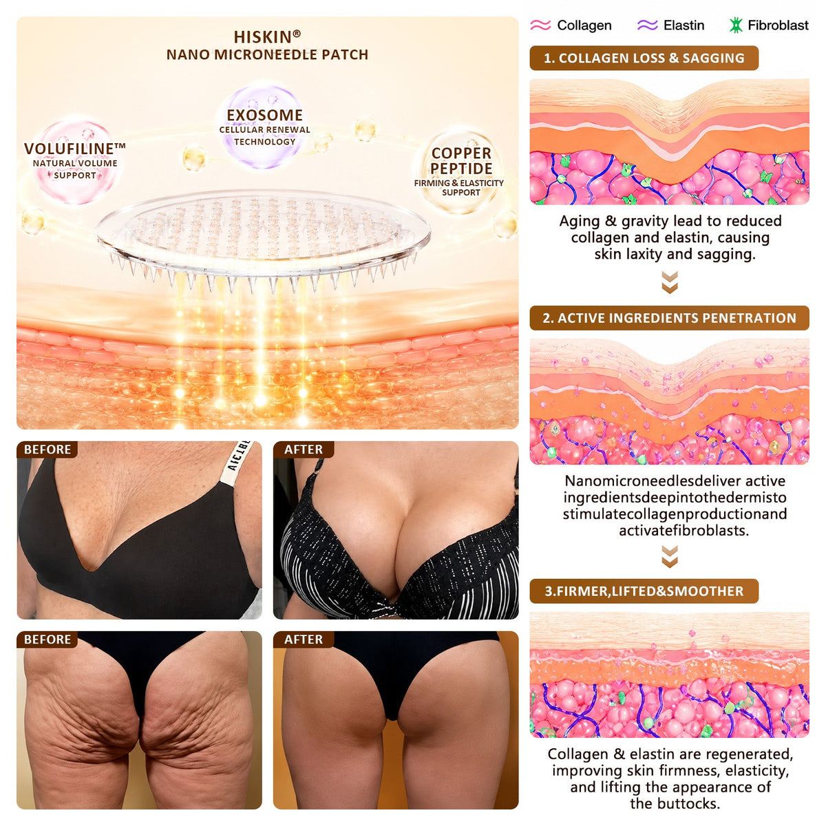 HISKIN®🏆 Bust Volume, Lift & Firming Nano Microneedle Patch Volufiline + Exosome + Copper Peptide Formula Powered by Cellular Renewal Technology (Copy)