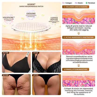 HISKIN®🏆 Bust Volume, Lift & Firming Nano Microneedle Patch Volufiline + Exosome + Copper Peptide Formula Powered by Cellular Renewal Technology (Copy)
